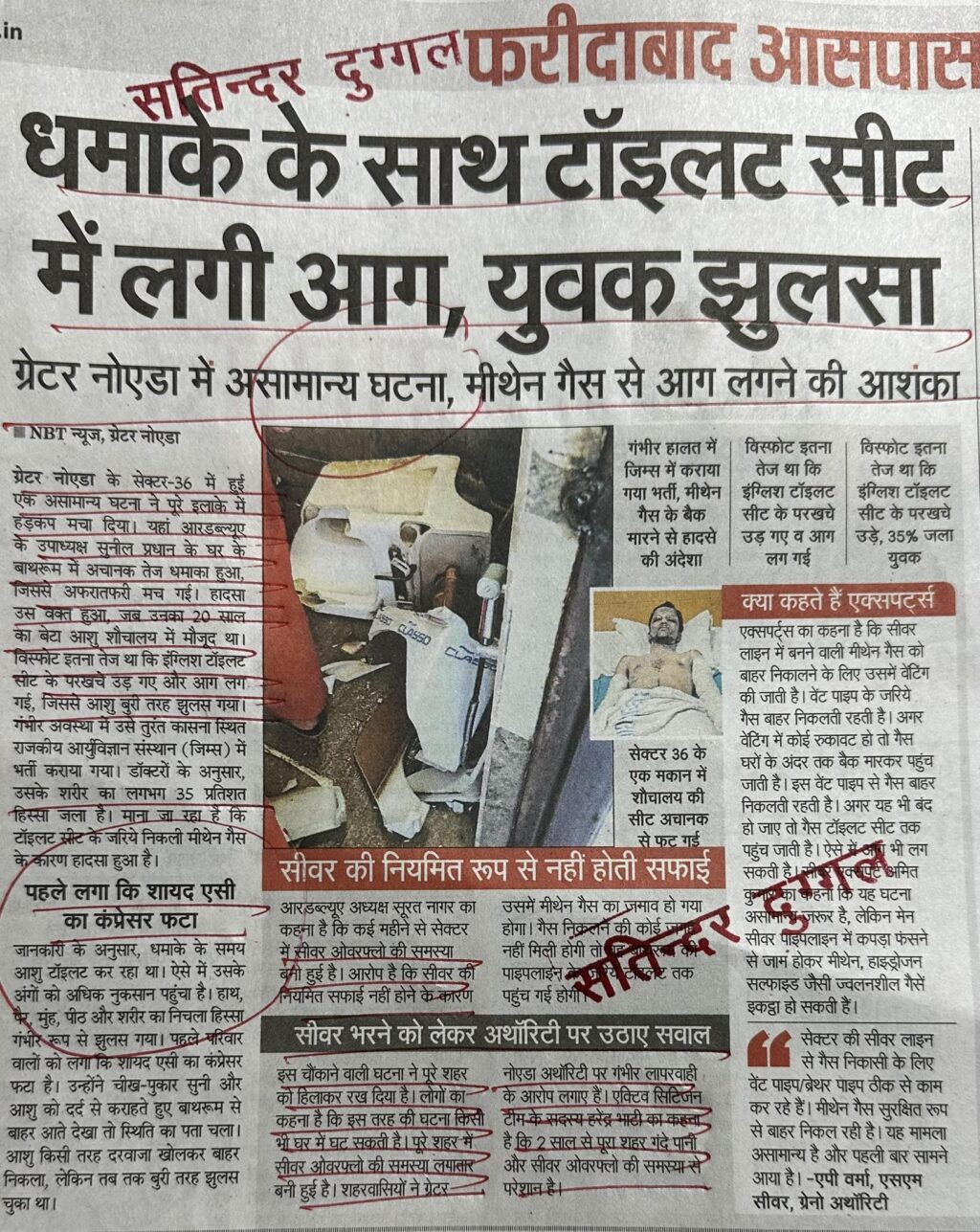 धमाके के साथ टॉइलट सीट में लगी आग, युवक झुलसा